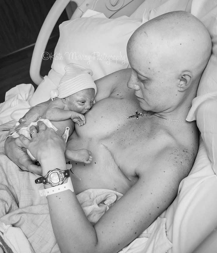 mujer con cancer e hijo